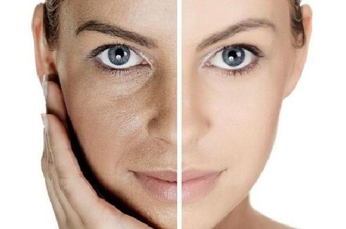 Machen Sie die Haut mit eigenem Blutplasma