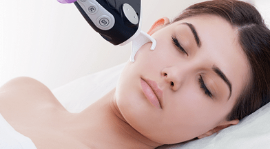 Was ist eine fraktionierte Hautverjüngung im Gesicht