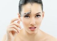 Mädchen nach fraktionierter Laser-Gesichtsverjüngung.