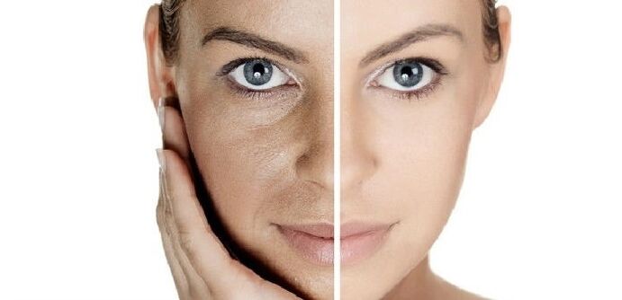 vor und nach der Gesichtshautverjüngung