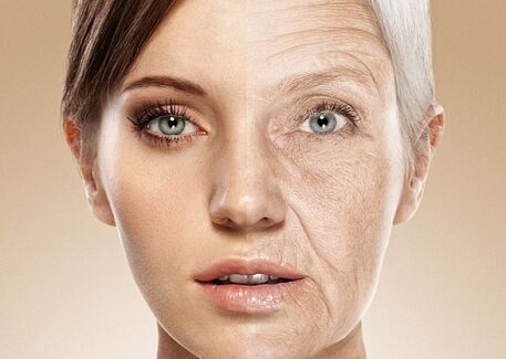 vor und nach der Lasererneuerung der Gesichtshaut