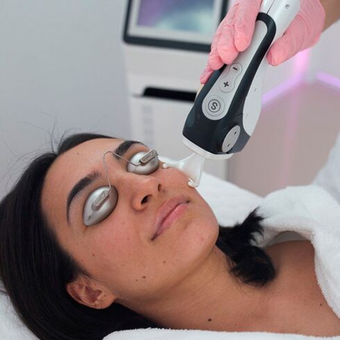 Fraktionierte Laser-Gesichtshautbehandlung